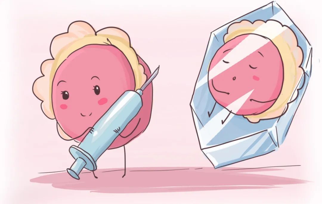 什么是经阴道穿刺取卵术？