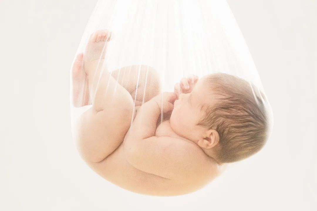 反复胎停、流产，可以直接做试管婴儿助孕吗？