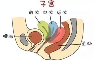 正常的子宫是什么样的? 正常的子宫是什么样的?