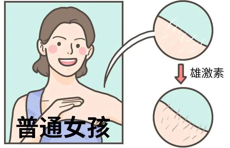 女性也需要雄激素? 女性也需要雄激素?