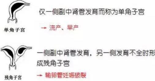 子宫畸形对妊娠有什么影响? 子宫畸形对妊娠有什么影响?