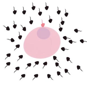 子宫内膜异位症为何会导致不孕? 子宫内膜异位症为何会导致不孕?