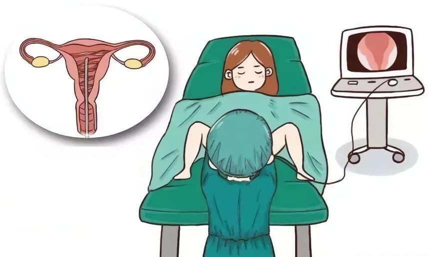 有哪些宫腔粘连的诊断方法? 有哪些宫腔粘连的诊断方法?