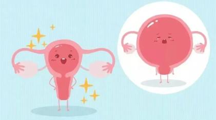 怎么诊断子宫内膜异位症? 怎么诊断子宫内膜异位症?