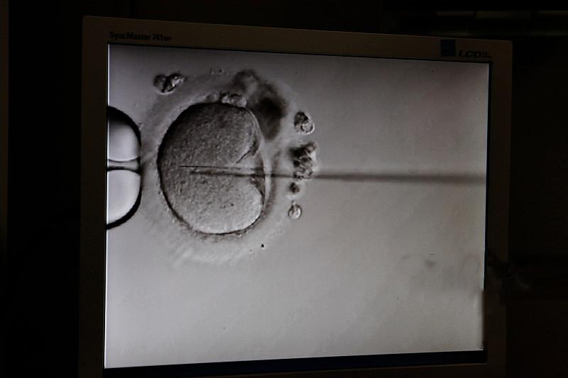 受孕必须要优质精子 受孕必须要优质精子