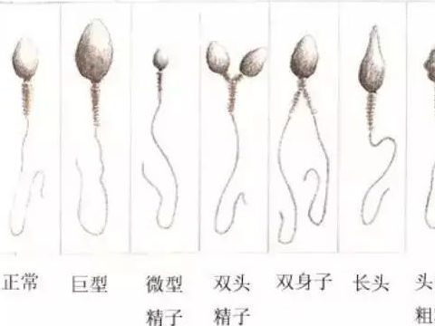 哪些不育症患者适合做试管婴儿 哪些不育症患者适合做试管婴儿