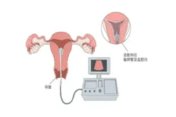 输卵管检查之后多久可以同房?这些注意事项让你避免不必要的风险！
