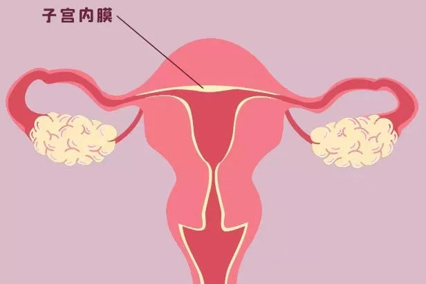 如何增厚子宫内膜？子宫内膜增厚有哪些方式和方法？