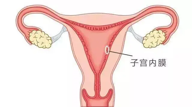 子宫内膜增厚咋回事？为什么会出现子宫内膜增厚？