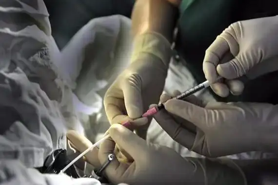 医院提供卵子捐赠，经济补偿多少合理？