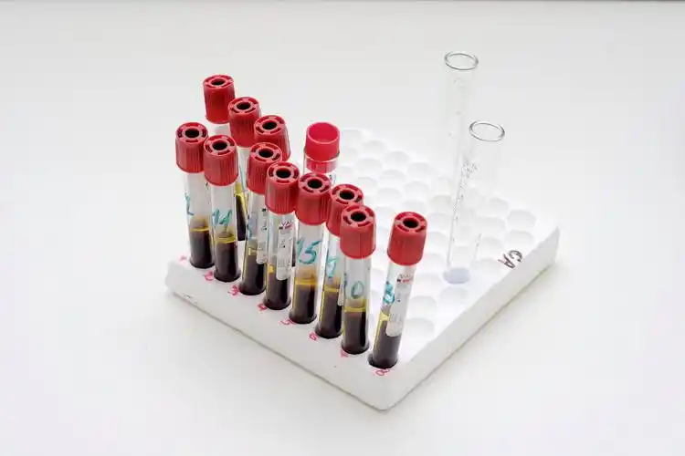 分析做试管多次生化的原因，受精卵缺陷是主要的影响因素