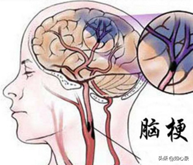 19年山东67岁大妈高龄产女,称工资过万不会麻烦子女,现状如何?