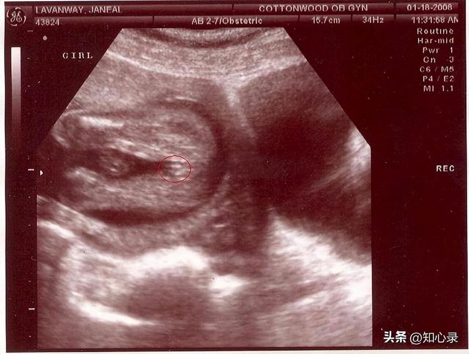 19年山东67岁大妈高龄产女,称工资过万不会麻烦子女,现状如何?